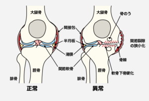膝関節図